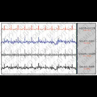 Медицинское программное обеспечение ECG Free