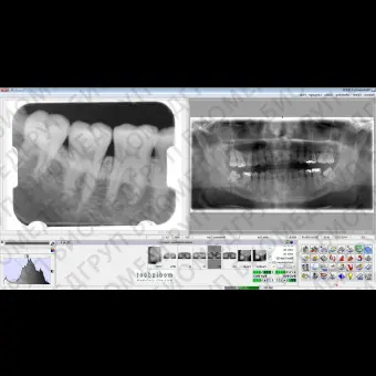 Программное обеспечение для обработки снимков зубов Mediadent