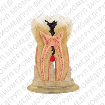TOOTH MODEL HTYPE модель зуба c сагиттальным разрезом