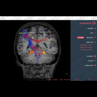 Программное обеспечение для МРТ Brainance MD