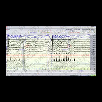 ЭЭГсистема 256 каналов Neurofax