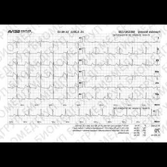 Электрокардиограф для спокойного состояния SEIVA Praktik