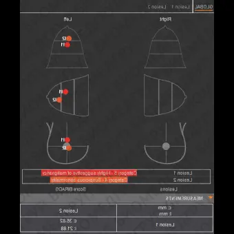 Клиническое программное обеспечение breastscape V1.0