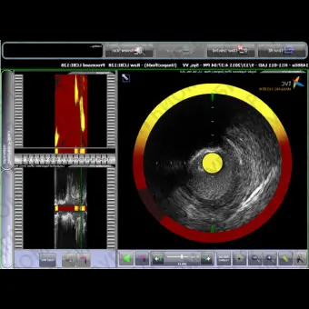 Ультразвуковой сканер на платформе TVC Imaging System