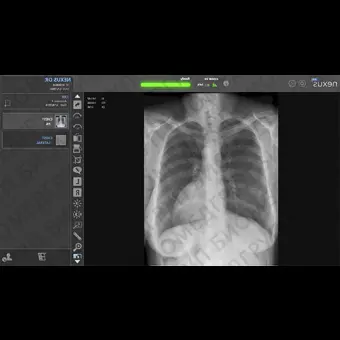 Система сбора данных для медицинских изображений для радиографии NexusDR