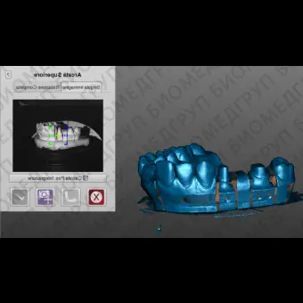 Программное обеспечение для обработки снимков зубов OpticalRevEng Dental 3.0