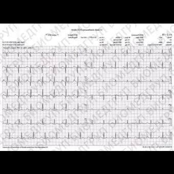 Электрокардиограф для спокойного состояния PE1201