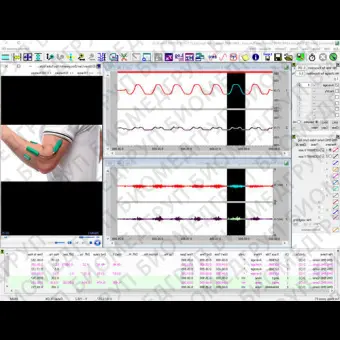 Программное обеспечение для EMG