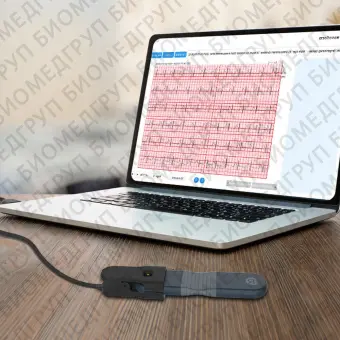 Кардиомонитор Холтера AI ECG