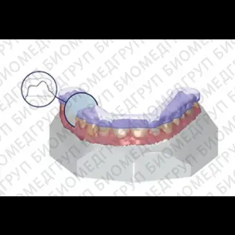 Ортодонтическое программное обеспечение SPLINT STUDIO