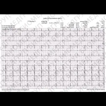 Электрокардиограф для спокойного состояния PE1201