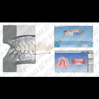 Программное обеспечение для стоматологии Planmeca Romexis Smile Design