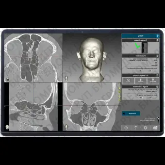 Система хирургической навигации для хирургической отоларингологии Navient ENT