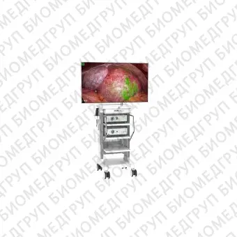 Эндоскопическая стойка для флуоресцентной визуализации 214K