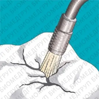 Sonicflex clean brush 5  насадкащетка валик малый для чистки зубов