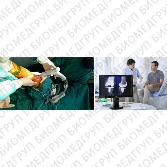 Система промыва пульсирующей струей ортопедическая хирургия WZWDS01