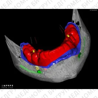 Программное обеспечение для обработки снимков зубов QuickVision 3D