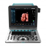 Переносной ультразвуковой сканер DW-P50