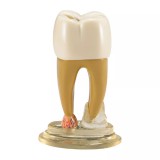 TOOTH MODEL R-TYPE - разборная модель зуба