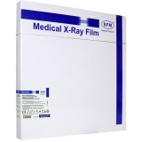 Рентгенплёнка SFM X-Ray BF 40х40 (синечувствительная)