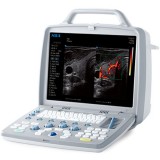 Siui CTS-8800plus Аппарат УЗИ