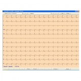 Медицинское программное обеспечение CardioTEKA